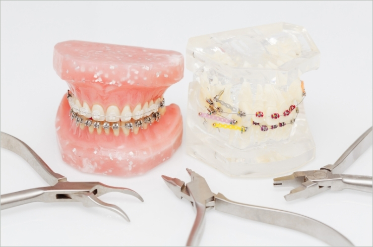 Orthodontics-image